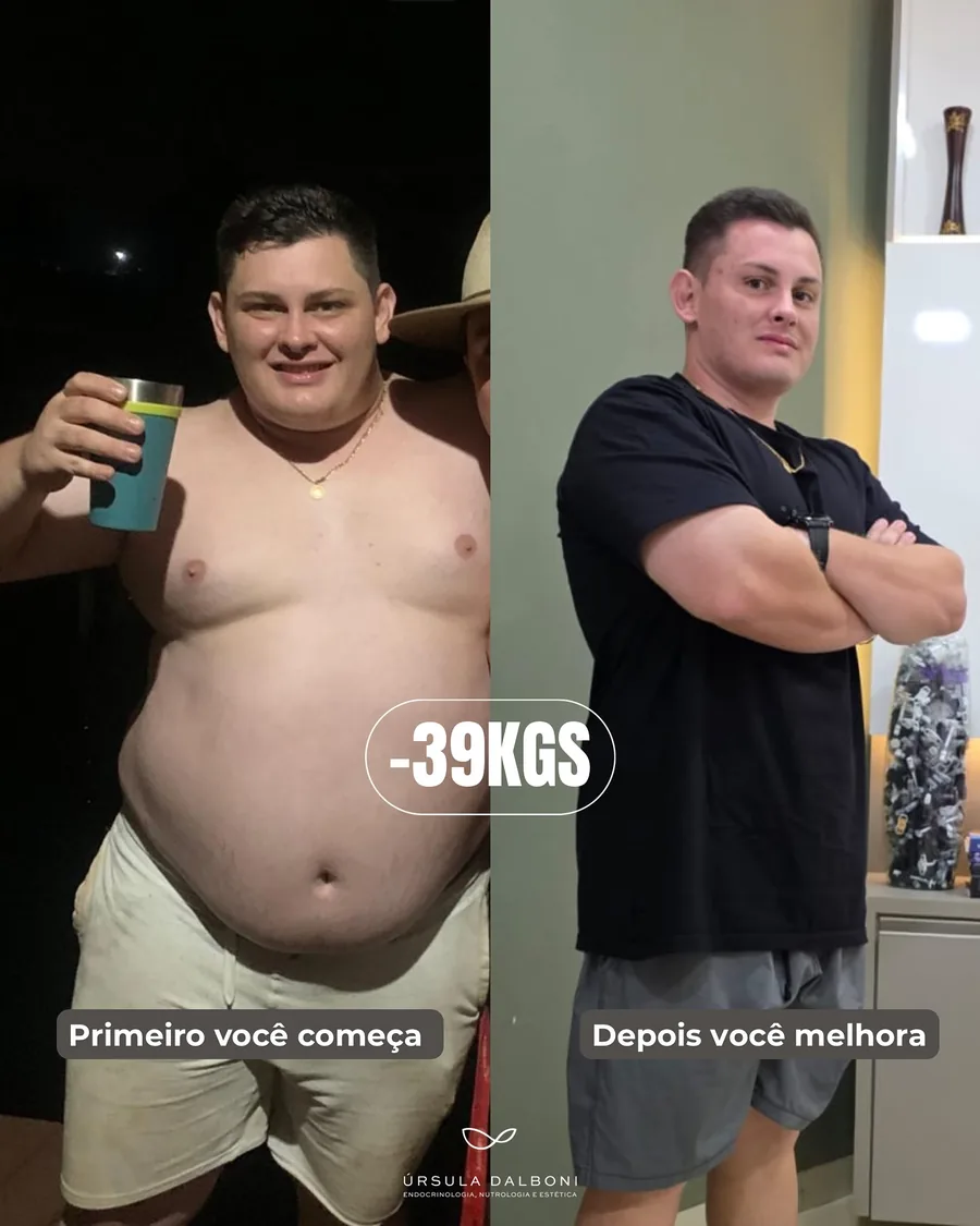 Paciente antes e depois do acompanhamento de emagrecimento